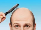 Как остановить выпадение волос у мужчин?