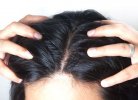 Массаж головы поможет от выпадения волос