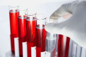 исследование крови на гормоны
