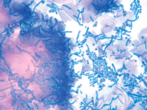Микроорганизм Malassezia Furfur