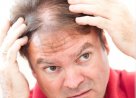 Что такое диффузное выпадение волос?